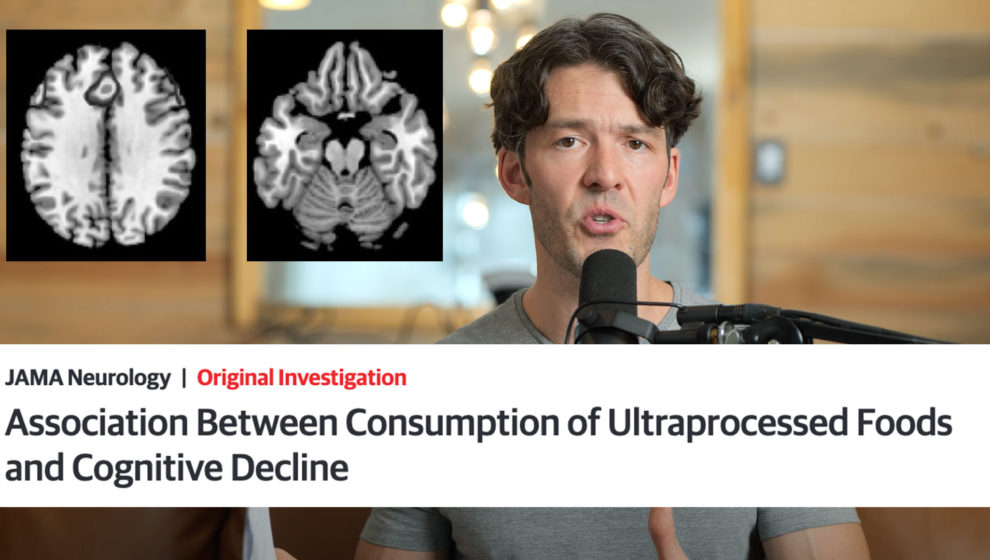 Damming Evidence: Processed Foods Hasten Cognitive Decline (brain atrophy)